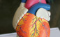 Afbeelding van Lean Six Sigma verbetert hartchirurgie